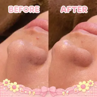 肌質改善専門 ハーブ /毛穴洗浄 リエイトのエステ・リラクイメージ