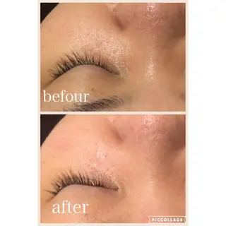 ニキビ跡専門サロン Ainaのエステ・リラクイメージ