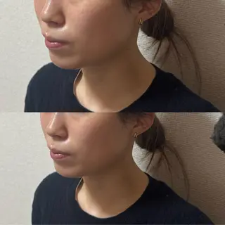 Amaranth所属・Lupinus 小顔矯正のエステ・リラクイメージ