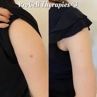 プライベートサロン アオラのネイルデザイン