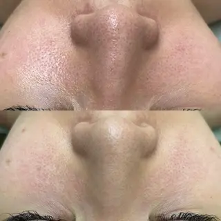 BeautySalo nCielChibaのエステ・リラクイメージ