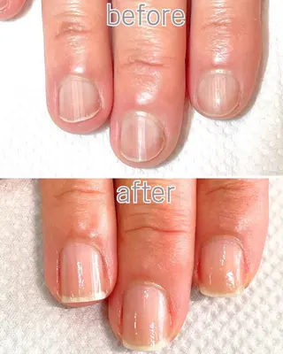 ネイル 自爪育成専門店 Kapilinaのネイルデザイン