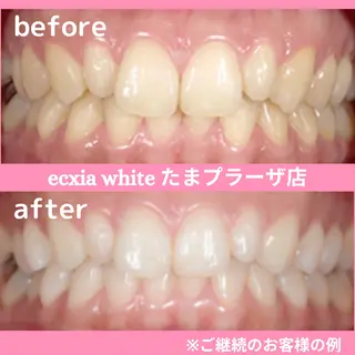 セルフホワイトニング　エクシアたまプラーザ店所属・yukari - オーナー -のその他イメージ
