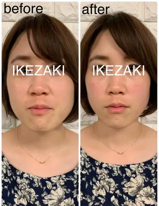 美容鍼 IKEZAKIのエステ・リラクイメージ