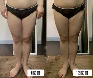 ハイパーナイフ専門店　Salon de COCO所属・Salon de COCOのエステ・リラクイメージ