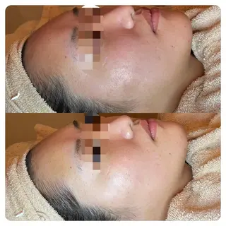 La beauté et santé岡崎店所属・望月 はるかのエステ・リラクイメージ