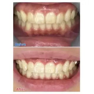 Ｍ渋谷 ホワイトニングのエステ・リラクイメージ