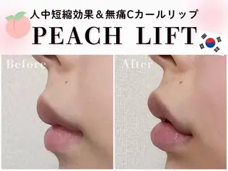 韓国肌管理🇰🇷 水光肌/肌質改善🫧のエステ・リラクイメージ