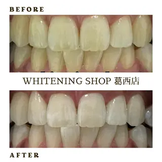 メンズ ホワイトニング ショップ葛西店のその他イメージ