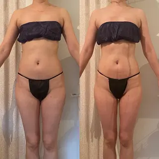 AKALA エステ リンパマッサージのエステ・リラクイメージ