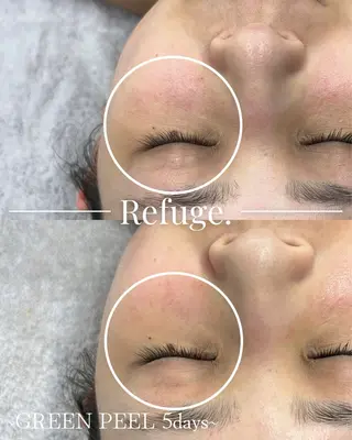 グリーンピール専門サロン Refuge.所属・Refuge. (リフュージュ)のエステ・リラクイメージ