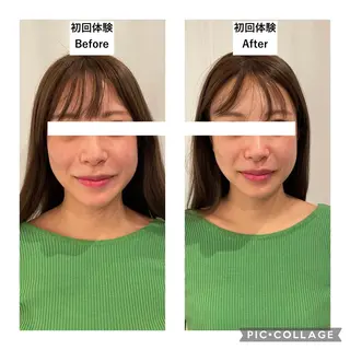 12Dハイフ💗 最強小顔のエステ・リラクイメージ