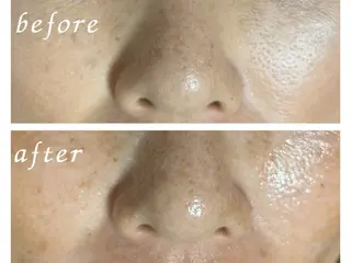 ホワイト ターコイズのエステ・リラクイメージ