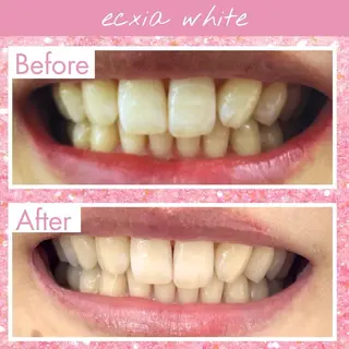 エクシア仙台駅東口店所属・セルフホワイトニング エクシア仙台駅東口店のその他イメージ