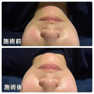 🌴Beauty Salon LANAのエステ・リラクイメージ