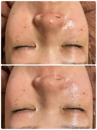 beauty  salon sorelle所属・産毛角質ケア/艶肌 フェイシャルワックスのエステ・リラクイメージ