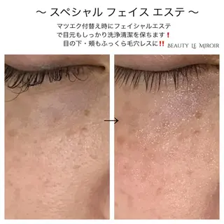 マツエク・マツパ ビューティー ミロワールのエステ・リラクイメージ