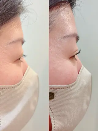 マツエク・マツパ I'LL（アイル）浜松三方原店所属・【モデルさん募集中 🎀平井】のマツエク・マツパデザイン