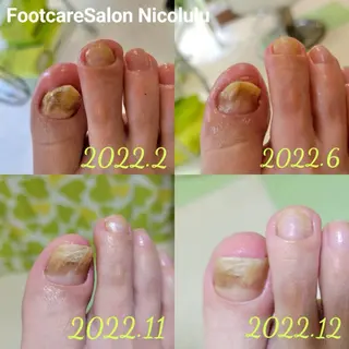 足トラブル専門 ニコルル金沢のエステ・リラクイメージ