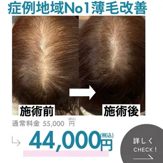 シミ・若返り特化 さゆみのエステ・リラクイメージ