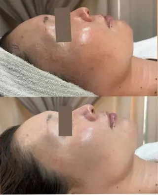 Meow！～トラブル肌専門ピーリング＆脱毛サロン～所属・トラブル肌改善🏥 Meow！🫧🫧のその他イメージ