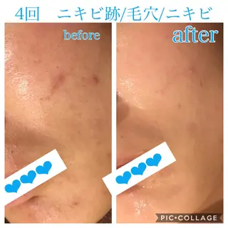 ロング カラー パーマ ヘアアレンジ メンズ キッズ ネイル マツエク・マツパ EnsorClair 代表　野口真央のエステ・リラクイメージ
