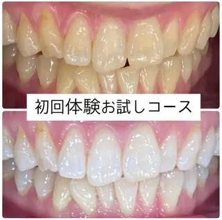 ホワイトニングルーム 横浜店のその他イメージ