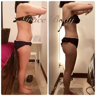 痩身・小顔・脱毛 グレイスボディのエステ・リラクイメージ