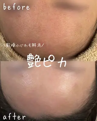 ｍｉkｉ 東根の肌質改善サロンのエステ・リラクイメージ