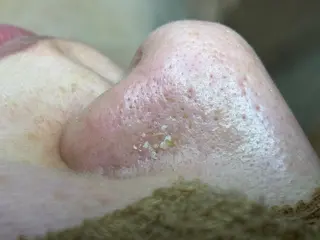 毛穴専門店【各務原】 天使の毛穴のエステ・リラクイメージ