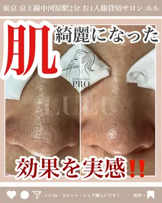 LULU ルルのエステ・リラクイメージ