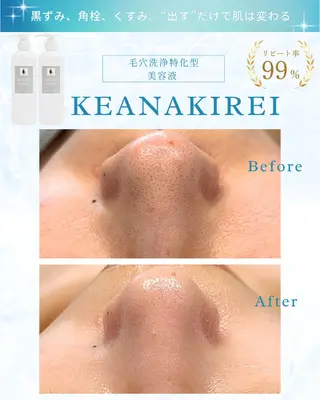 LiAm《美肌管理/ 小顔/脂肪ケア》のその他イメージ