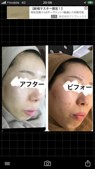 ショート カラー パーマ ヘアアレンジ メンズ キッズ ネイル マツエク・マツパ アイブロウ ハーブピーリング専門 🌿モッカのエステ・リラクイメージ