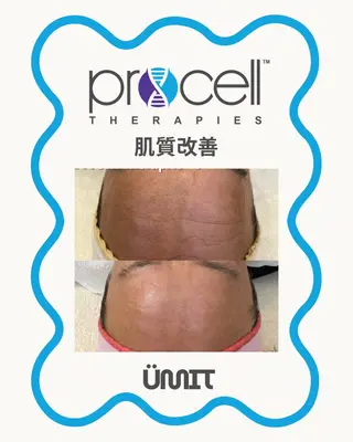 Ümit(ユミト) プロセルセラピーズのネイルデザイン