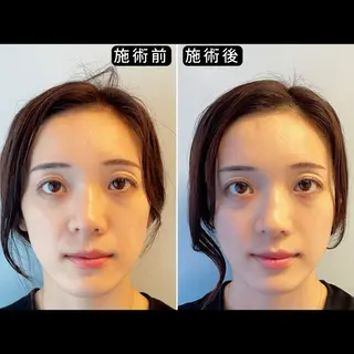 渋谷 小顔美容鍼 専門サロン YZのエステ・リラクイメージ