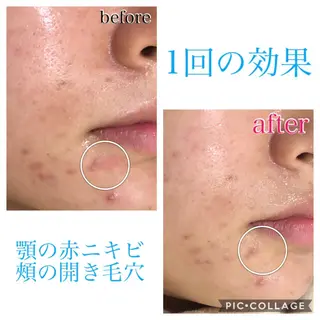ショート カラー パーマ ヘアアレンジ キッズ ネイル マツエク・マツパ EnsorClair 代表 野口真央のエステ・リラクイメージ