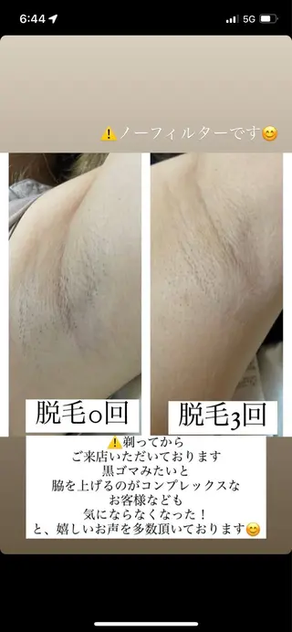 Anela .のマツエク・マツパデザイン