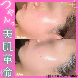 痩身&美肌サロン 堀米✨のその他イメージ