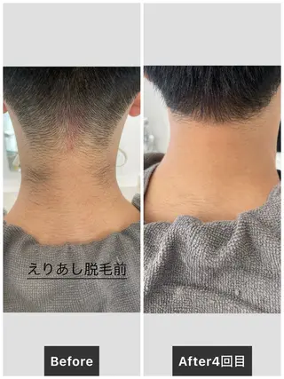 ELEGANCE所属・メンズ脱毛サロン BRIGHTのエステ・リラクイメージ