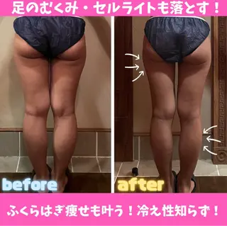 痩身&美肌サロン 堀米✨のその他イメージ