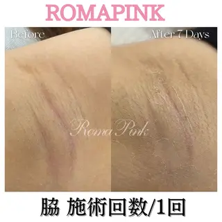 トータルビューティー サロンSalaのマツエク・マツパデザイン