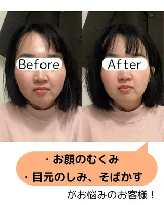 出張鍼灸師 miyuのエステ・リラクイメージ