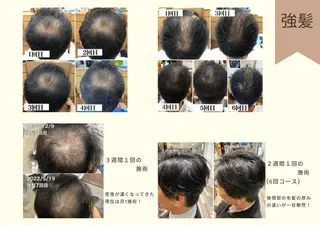 メンズ 痩身・脱毛・美髪ケア 【GLYCINE】のエステ・リラクイメージ