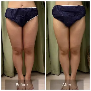 【元に戻らない】 小顔&部分痩せのその他イメージ