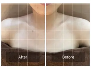 心斎橋痩身ダイエット 韓国.美容鍼.小顔のエステ・リラクイメージ