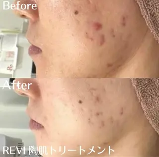 中目黒ハーブピーリン グ🌿ララピールのエステ・リラクイメージ