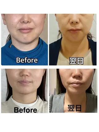 SINCERE MIYUKIのエステ・リラクイメージ