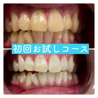 ホワイトニングルーム 横浜店のその他イメージ