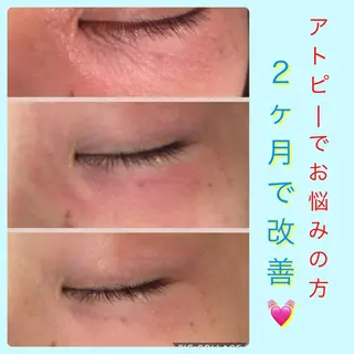 ミディアム カラー パーマ ヘアアレンジ メンズ キッズ ネイル マツエク・マツパ ニキビ・肌質改善専門 ♡人生が変わるサロンのエステ・リラクイメージ