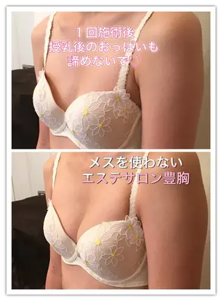 女性のお悩み美容 サロン ヴィーナスのエステ・リラクイメージ